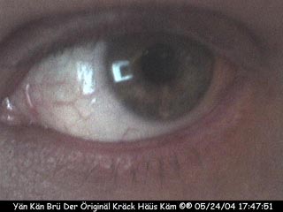 SkotCam21
